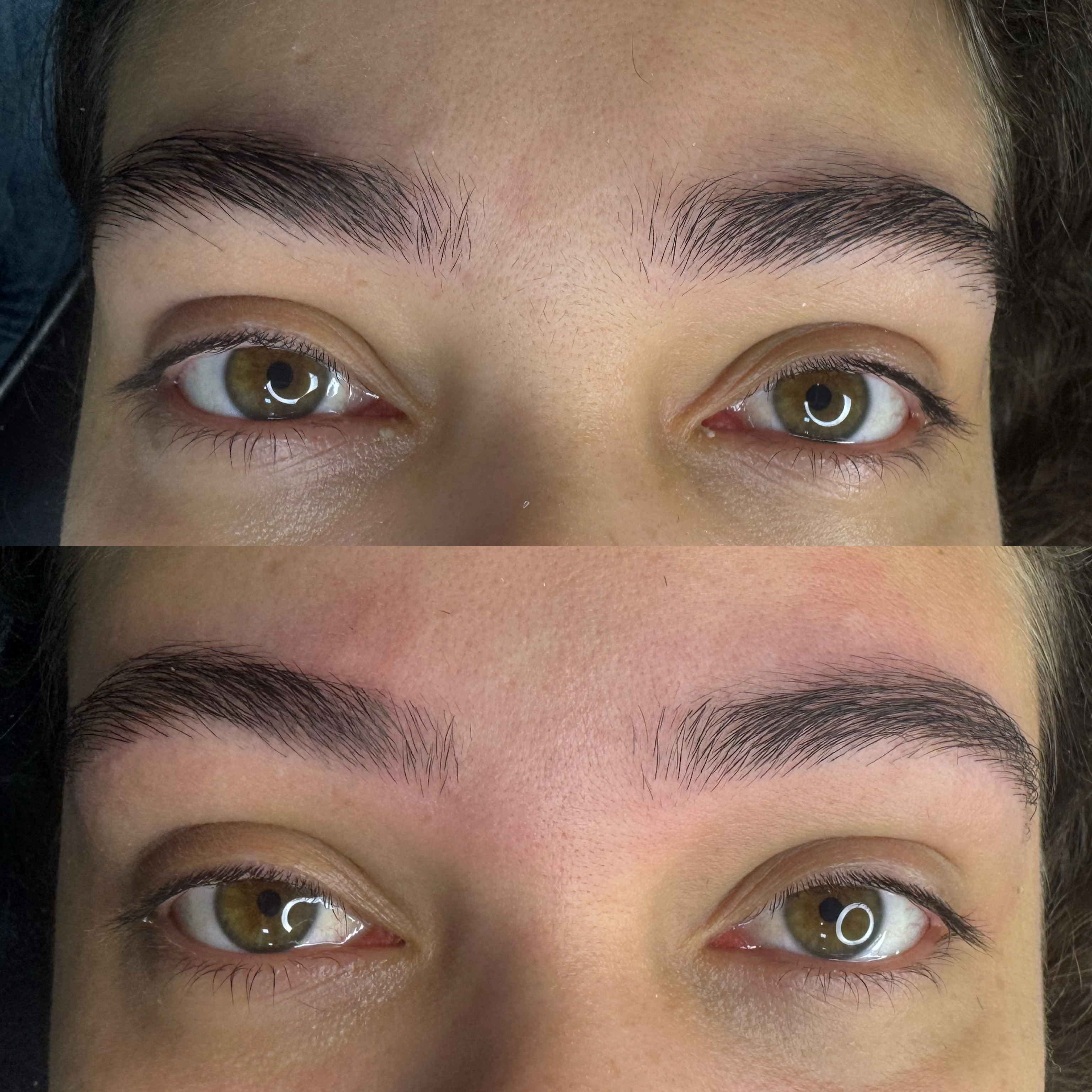 Resultado de tratamento - Antes e Depois